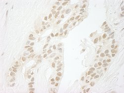 PPP1CC Polyclonal Antibody, Bethyl Laboratories:Antibodies:Primary Antibodies