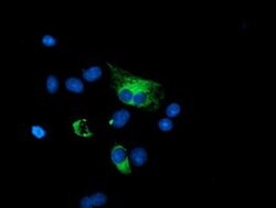 PPP1R15A Monoclonal Antibody (OTI4F1), TrueMAB , OriGene 30 &mu;L; Unconjugated:Antibodies,