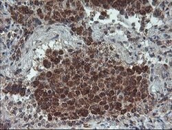 PPP1R15A Monoclonal Antibody (OTI4F1), TrueMAB , OriGene 30 &mu;L; Unconjugated:Antibodies,