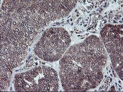 PPP1R15A Monoclonal Antibody (OTI4F1), TrueMAB , OriGene 30 &mu;L; Unconjugated:Antibodies,