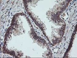 PPP1R15A Monoclonal Antibody (OTI4F1), TrueMAB , OriGene 30 &mu;L; Unconjugated:Antibodies,