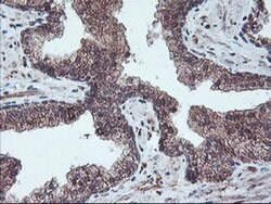 PPP1R15A Monoclonal Antibody (OTI4F1), TrueMAB , OriGene 30 &mu;L; Unconjugated:Antibodies,