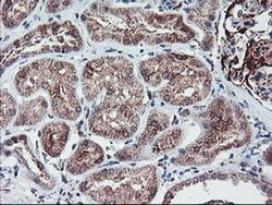 PPP1R15A Monoclonal Antibody (OTI4F1), TrueMAB , OriGene 30 &mu;L; Unconjugated:Antibodies,
