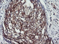 PPP1R15A Monoclonal Antibody (OTI1E1), TrueMAB , OriGene 100 &mu;L; Unconjugated:Antibodies,