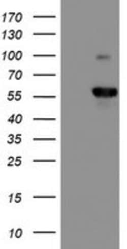 PPP1R15A Mouse anti-Human, Mouse, Clone: OTI2B11, lyophilized, TrueMAB
