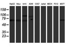 PPP1R15A Mouse anti-Human, Mouse, Clone: OTI2B11, lyophilized, TrueMAB