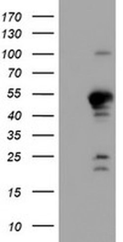 PPP1R15A Monoclonal Antibody (OTI4F1), TrueMAB , OriGene 30 &mu;L; Unconjugated:Antibodies,