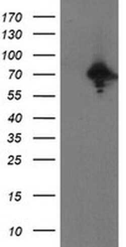PPP1R15A Monoclonal Antibody (OTI1E1), TrueMAB , OriGene 100 &mu;L; Unconjugated:Antibodies,