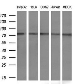 PPP1R15A Monoclonal Antibody (OTI1E1), TrueMAB , OriGene 100 &mu;L; Unconjugated:Antibodies,
