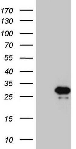 PPP1R17 Monoclonal Antibody (OTI2A8), TrueMAB , OriGene 100 &mu;L; Unconjugated:Antibodies,