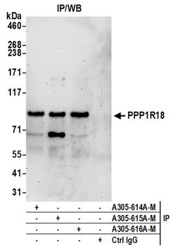 PPP1R18 Polyclonal Antibody, Bethyl Laboratories 20 &mu;L; Unconjugated:Antibodies,
