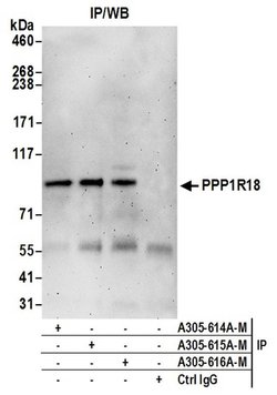 PPP1R18 Polyclonal Antibody, Bethyl Laboratories 20 &mu;L; Unconjugated:Antibodies,