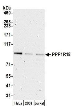 PPP1R18 Polyclonal Antibody, Bethyl Laboratories 20 &mu;L; Unconjugated:Antibodies,