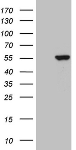 PPP1R36 Mouse anti-Human, Clone: OTI5F6, lyophilized, TrueMAB 100 &mu;g;