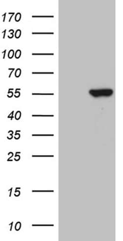 PPP1R36 Monoclonal Antibody (OTI5F6), TrueMAB , OriGene 100 &mu;L; Unconjugated:Anticuerpos