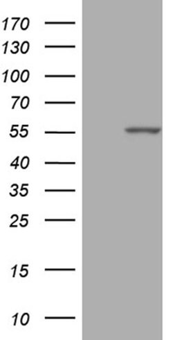 PPP1R36 Mouse anti-Human, Clone: OTI3B9, lyophilized, TrueMAB 100 &mu;g;