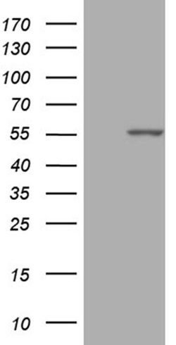 PPP1R36 Monoclonal Antibody (OTI3B9), TrueMAB , OriGene 100 &mu;L; Unconjugated:Antibodies,