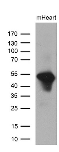 PPP1R36 Mouse anti-Human, Clone: OTI3B9, lyophilized, TrueMAB 100 &mu;g;