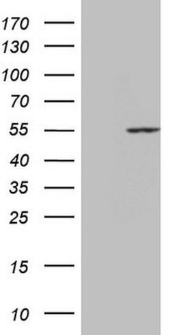 PPP1R36 Mouse anti-Human, Clone: OTI5C10, lyophilized, TrueMAB 100 &mu;g;