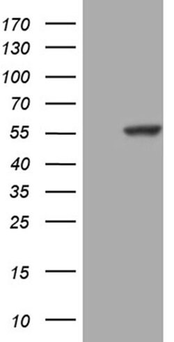 PPP1R36 Monoclonal Antibody (OTI7A9), TrueMAB , OriGene 100 &mu;L; Unconjugated:Antibodies,