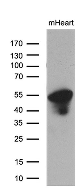 PPP1R36 Monoclonal Antibody (OTI7A9), TrueMAB , OriGene 100 &mu;L; Unconjugated:Antibodies,