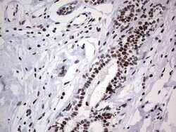 PPP1R8 Monoclonal Antibody (OTI4E5), TrueMAB , OriGene 100 &mu;L; Unconjugated:Antibodies,