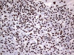 PPP1R8 Monoclonal Antibody (OTI4E5), TrueMAB , OriGene:Antibodies:Primary
