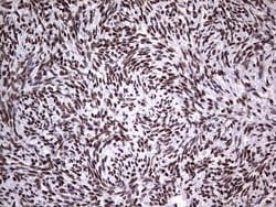 PPP1R8 Monoclonal Antibody (OTI4E5), TrueMAB , OriGene 100 &mu;L; Unconjugated:Antibodies,