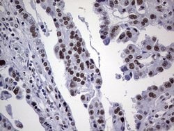 PPP1R8 Monoclonal Antibody (OTI4E5), TrueMAB , OriGene 100 &mu;L; Unconjugated:Antibodies,