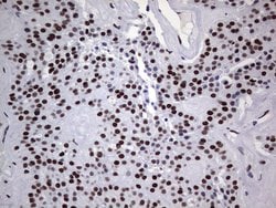 PPP1R8 Monoclonal Antibody (OTI4E5), TrueMAB , OriGene 100 &mu;L; Unconjugated:Antibodies,