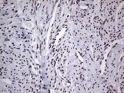 PPP1R8 Monoclonal Antibody (OTI4E5), TrueMAB , OriGene 100 &mu;L; Unconjugated:Antibodies,