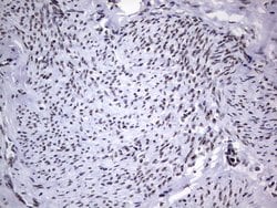 PPP1R8 Monoclonal Antibody (OTI4E5), TrueMAB , OriGene 100 &mu;L; Unconjugated:Antibodies,
