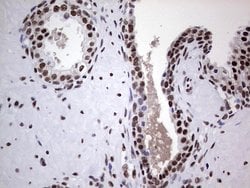 PPP1R8 Monoclonal Antibody (OTI4E5), TrueMAB , OriGene 100 &mu;L; Unconjugated:Antibodies,