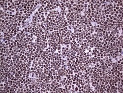PPP1R8 Monoclonal Antibody (OTI4E5), TrueMAB , OriGene 100 &mu;L; Unconjugated:Antibodies,