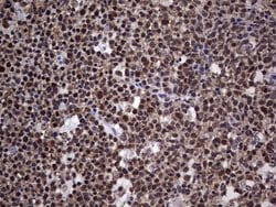 PPP1R8 Monoclonal Antibody (OTI4E5), TrueMAB , OriGene 100 &mu;L; Unconjugated:Antibodies,