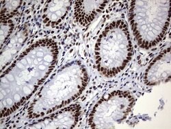 PPP1R8 Monoclonal Antibody (OTI4E5), TrueMAB , OriGene 100 &mu;L; Unconjugated:Antibodies,