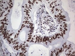PPP1R8 Monoclonal Antibody (OTI4E5), TrueMAB , OriGene 100 &mu;L; Unconjugated:Antibodies,