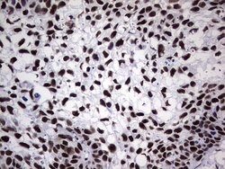 PPP1R8 Monoclonal Antibody (OTI4E5), TrueMAB , OriGene 100 &mu;L; Unconjugated:Antibodies,