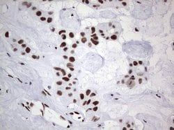 PPP1R8 Monoclonal Antibody (OTI4E5), TrueMAB , OriGene 100 &mu;L; Unconjugated:Antibodies,