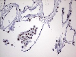 PPP1R8 Monoclonal Antibody (OTI4E5), TrueMAB , OriGene 100 &mu;L; Unconjugated:Antibodies,