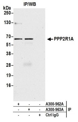 PPP2R1A Rabbit anti-Human, Polyclonal, Bethyl Laboratories 10 &mu;L; Unconjugated:Antibodies,