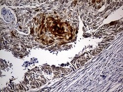 PPP2R1B Mouse anti-Human, Clone: OTI8B6, lyophilized, TrueMAB 100 &mu;g;