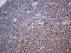 PPP2R1B Mouse anti-Human, Clone: OTI8B6, lyophilized, TrueMAB 100 &mu;g;