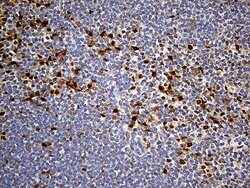 PPP2R1B Mouse anti-Human, Clone: OTI8B6, lyophilized, TrueMAB 100 &mu;g;