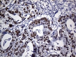 PPP2R1B Mouse anti-Human, Clone: OTI8B6, lyophilized, TrueMAB 100 &mu;g;