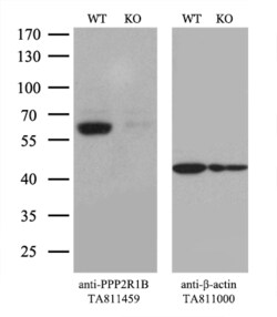 PPP2R1B Monoclonal Antibody (OTI8C5), TrueMAB , OriGene 30 &mu;L; Unconjugated:Antibodies,
