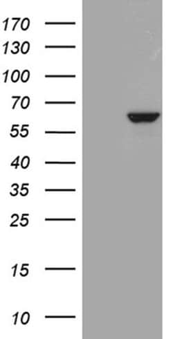 PPP2R1B Monoclonal Antibody (OTI9F3), TrueMAB , OriGene:Antibodies:Primary