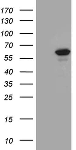 PPP2R1B Mouse anti-Human, Clone: OTI8B6, lyophilized, TrueMAB 100 &mu;g;