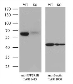 PPP2R1B Mouse anti-Human, Clone: OTI8B6, lyophilized, TrueMAB 100 &mu;g;