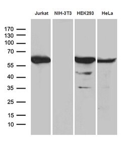 PPP2R1B Mouse anti-Human, Clone: OTI8B6, lyophilized, TrueMAB 100 &mu;g;